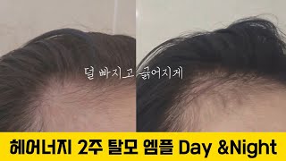 바르는 순간 시원~ 탈모 두피앰플 탈모앰플