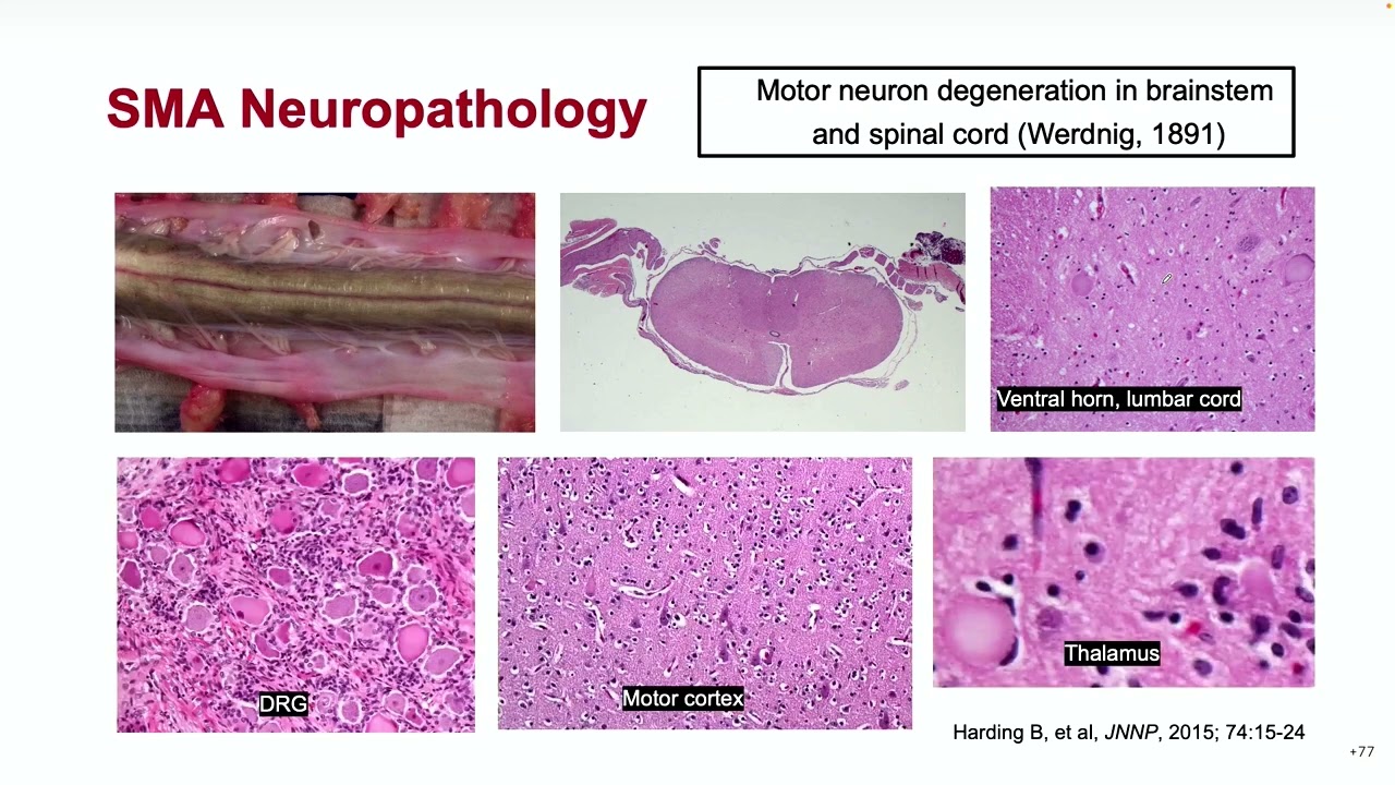 Gene-Targeted Therapy for Neurodevelopmental and Neurodegenerative Disorders