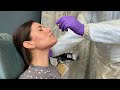 NEJM How to Obtain a Nasopharyngeal Swab Specimen