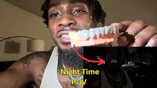 Moissanite Grillz From The IceGiant Review and Unboxing