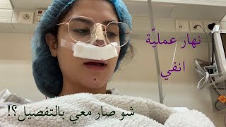 عملت عمليّة تجميل لأنفي شو صار معي بالتفصيل؟I did a nose job Everything you need to know