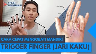 Cara Cepat Mengobati Mandiri TRIGGER FINGER/Jari Kaku (Fisioterapi)