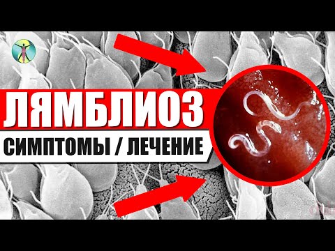 Лямблии у детей и взрослых!! Симптомы и лечение лямблиоза.