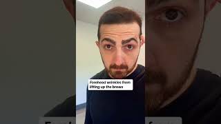 Forehead wrinkles… frown lines… crow’s feet… and you’re way too young for them No one talks about