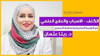  د. ريتا عثمان | الكلف أسبابه وعلاجه بالطريقة الأفضل