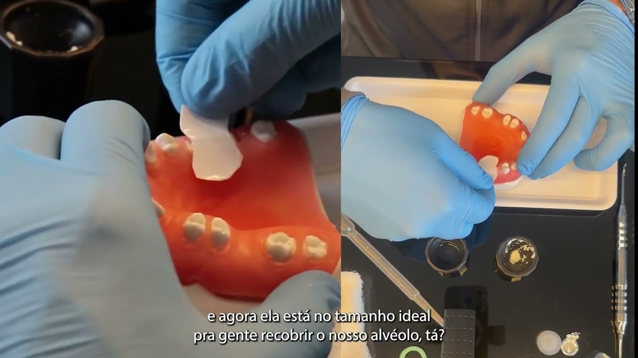 MANIPULAÇÃO EM MANEQUIM COM LUMINA PTFE, POR DR. GUSTAVO MOMESSO