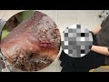😱🦶 Jigger Gigante Extraído – Limpeza Completa dos Pés! #BQ017