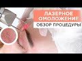 ЛАЗЕРНОЕ ОМОЛОЖЕНИЕ: Просто о сложном и преимущества процедуры