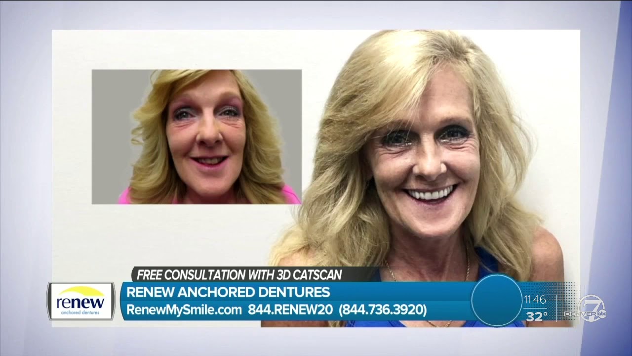 FREE Consultation and CAT Scan - Renew Anchored Dentures