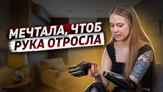 Родилась без руки | Катя Крюк