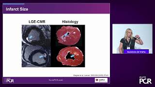Is PCI enough in STEMI? - EuroPCR 2022