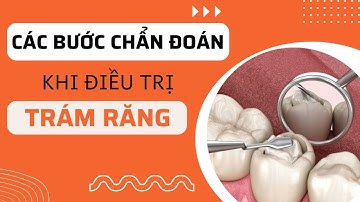 Các bước chẩn đoán khi điều trị trám răng | Tt niềng răng quốc tế Diamond