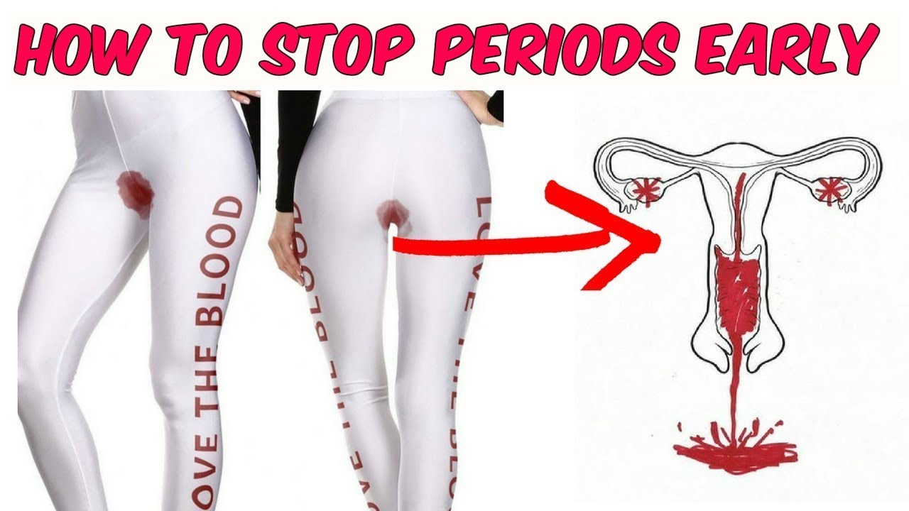 how-to-stop-your-periods-early-5-easy-ways-to-stop-your-early-periods