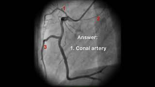 Cardiology quiz || Identify the branches of RCA