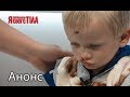 Сотворить настоящее чудо! – Я стесняюсь своего тела. Смотрите 22 марта