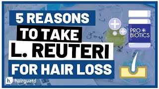 Top 5 Reasons To Take L REUTERI for HAIR LOSS