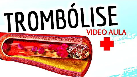 O que é a trombólise?