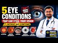 5 Silent Eye Diseases That Can Steal Your Vision Without Warning! | Dr S Manna