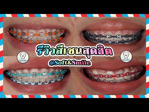 รีวิวสียางจัดฟัน  สีเชนสวยๆ