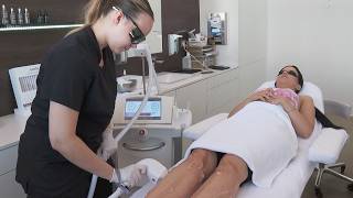 No More Stubble: Smooth Skin with Light Pulses