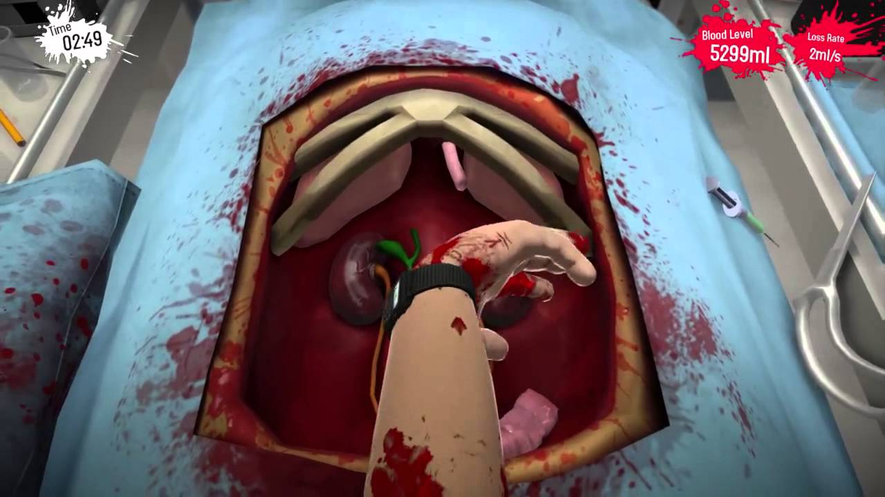 where to cut kidney transplant surgeon simulator
