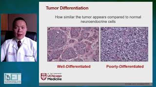 Intro to Neuroendocrine Tumors  ChihYi “Andy” Liao