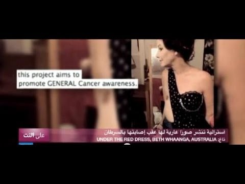 على النت استرالية تنشر صورا عارية لها عقب اصابتها بالسرطان