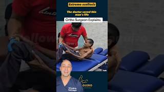 Doctor “Saves” his Scoliosis!? #shorts