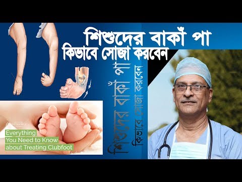 ভিডিও: আমার বাচ্চার কি ক্লাবফুট আছে?