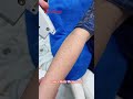 Laser Hair Removal #viralvideo #getsmarthairclub #haircare