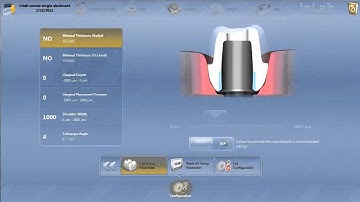 inLab 4.0 Abutment Global Parameters