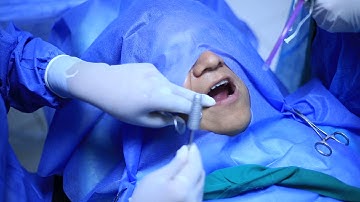 Implantes dentales en Clinica dental Integradent video producido por Moda Total Agency