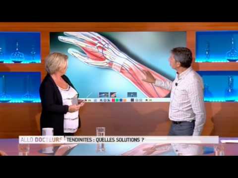 Vidéo: Qu'est-ce que la chirurgie des biceps ?