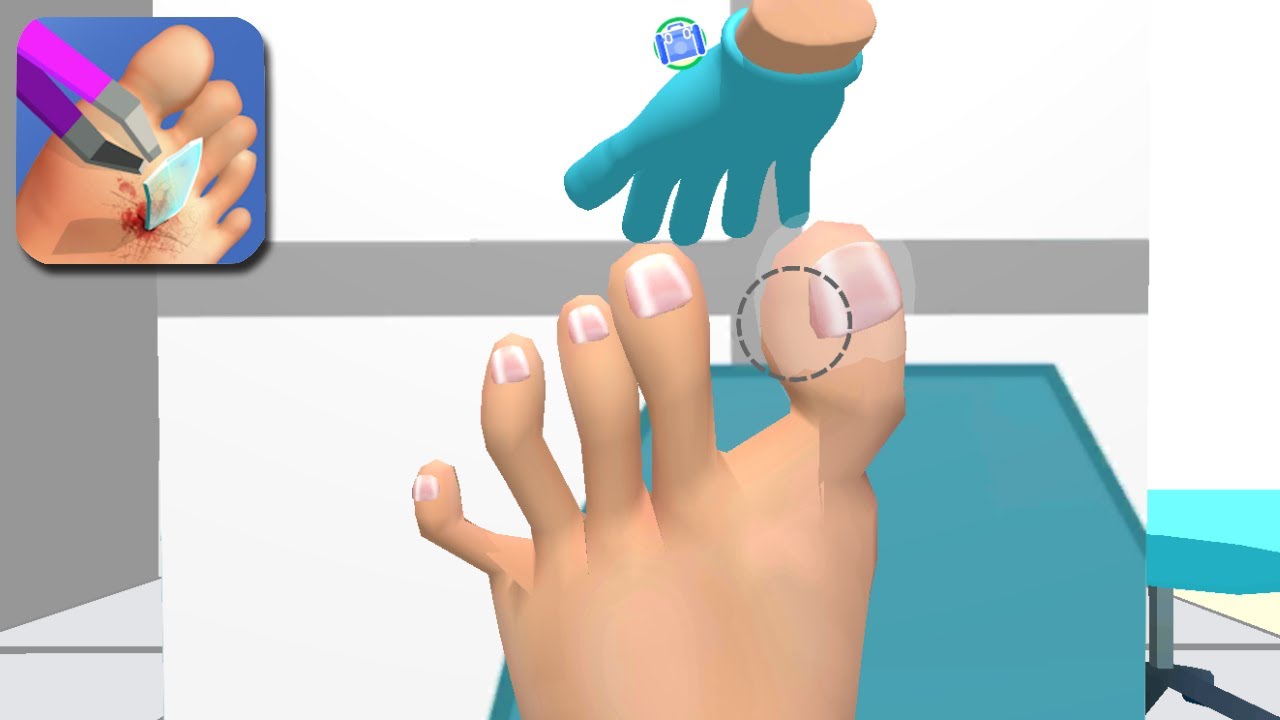 Foot Clinic - All Levels Gameplay Walkthrough Part 1 (Android/iOS)