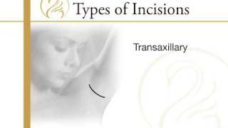 Atlanta Mammoplasty - The Swan Center for Plastic Surgery