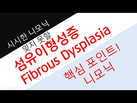 [니모닉] 섬유이형성증 (fibrous dysplasia)