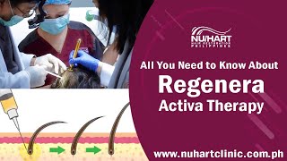 Regenera Activa (Micrografting Regenerative Hair Loss Treatment)