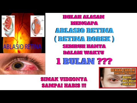 RETINA MATA ROBEK SEMBUH HANYA DENGAN BERRYTEIN ( 0851-0732-3330 )