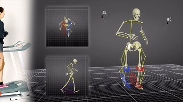 Running 3D Motion Analysis at NYDNRehab clinic