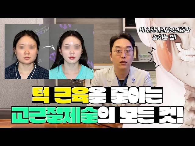 뼈를 깎아도 넙데데한 얼굴, 교근절제술 필요한 사람 누구?🤨