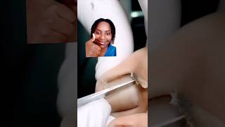 EASY TREATMENT FOR NARROW NAIL #nails #mrtoenail #shortvideo #shortviral #viral #youtubeshorts