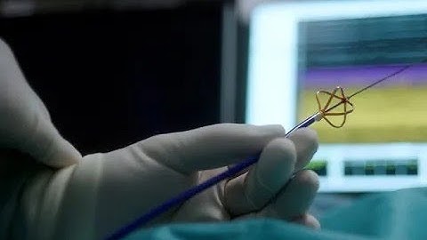 FARAPULSE™ Wave Series: Episode 5 - Promising Future with Pulsed Field Ablation