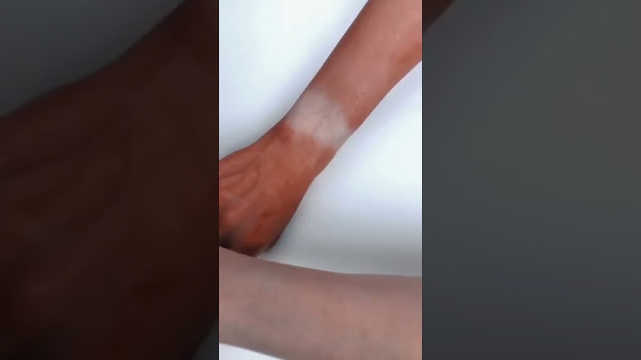 How to Create 1st Degree Burns Using Makeup