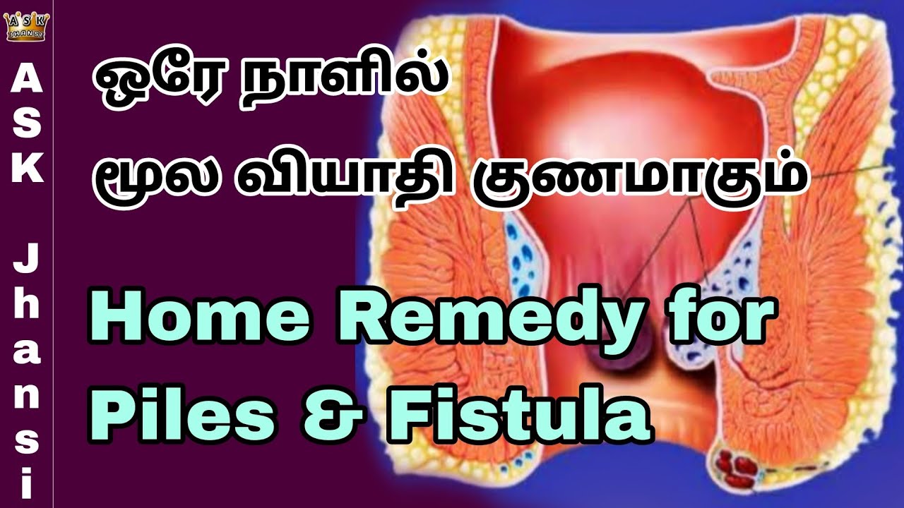 Piles Problem Treatment Tamil ஒரே நாளில் மூல வியாதி குணமாக வீட்டு