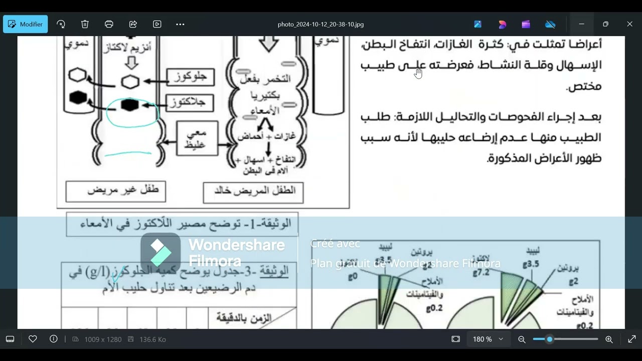 حل وضعية ادماجية حول انزيم اللاكتاز من امتحان الشهادة لسنة 2022
