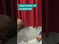 "Tubercular Lymph Node Swelling in Infants | Dr. Vivekanand#shorts#ytstudio #baby #patna 🧑‍🎨