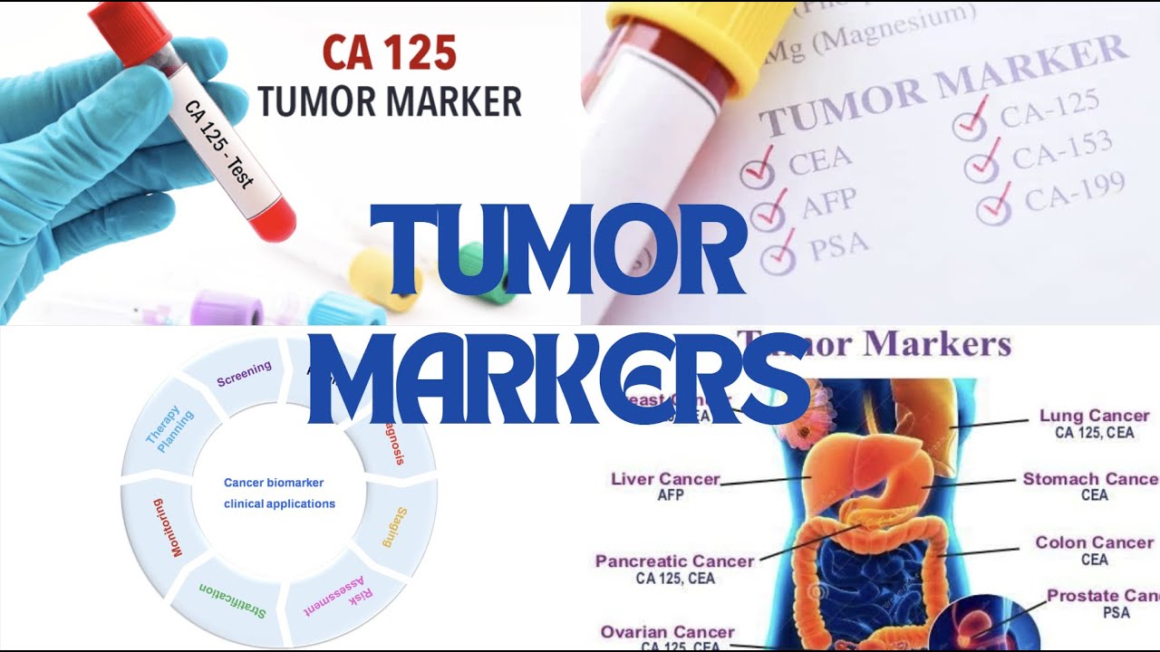 Tumor markers | Radiotherapy Edutech | Common terms in Oncology 