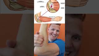 selvbehandling tips for din tennis albue! #selvbehandling #shorts