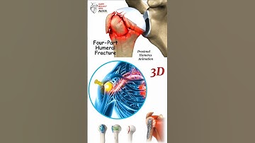 Proximal Humerus Animation | humerus factures animation | humerus animation | BiologywithAliya