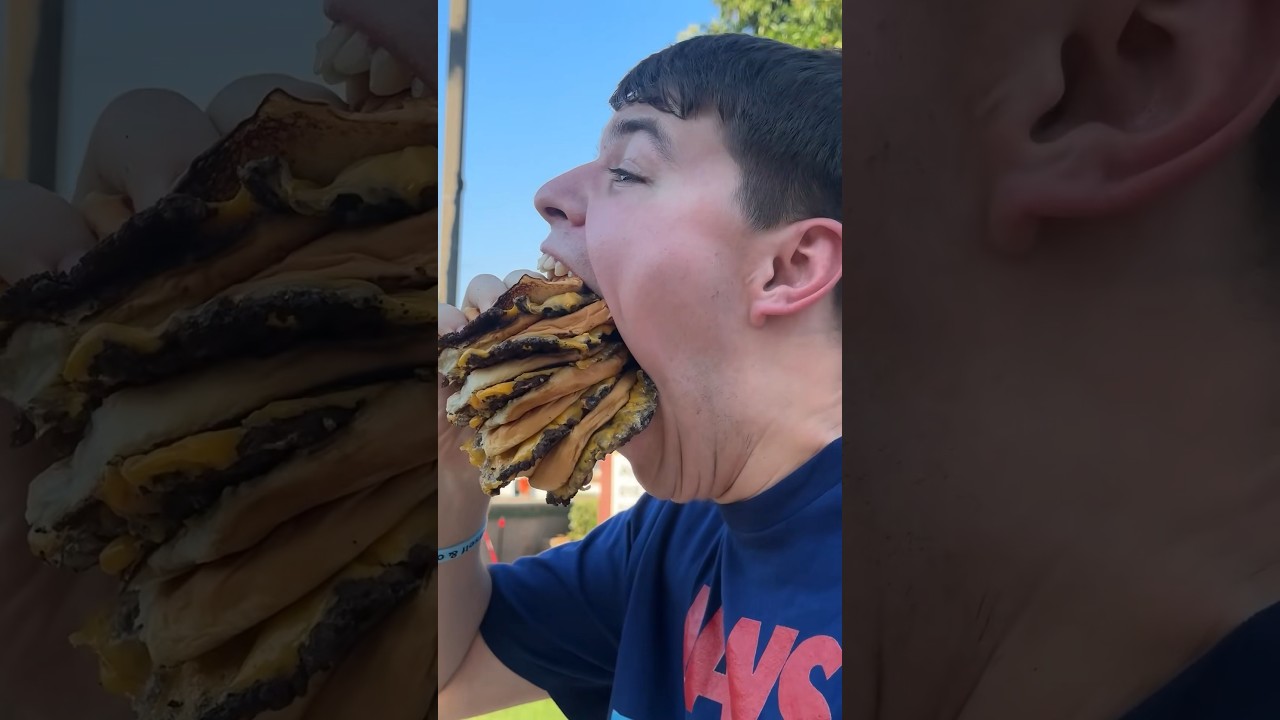 This Is What Dentist Mean When They Say Open WIDE! 😮🍔